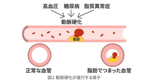 中 折れ 原因 20 代